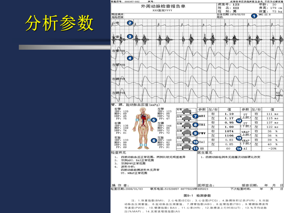 外周动脉检测分析技术课件.ppt_第1页