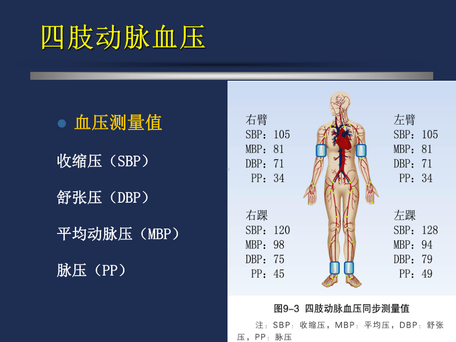 外周动脉检测分析技术课件.ppt_第3页