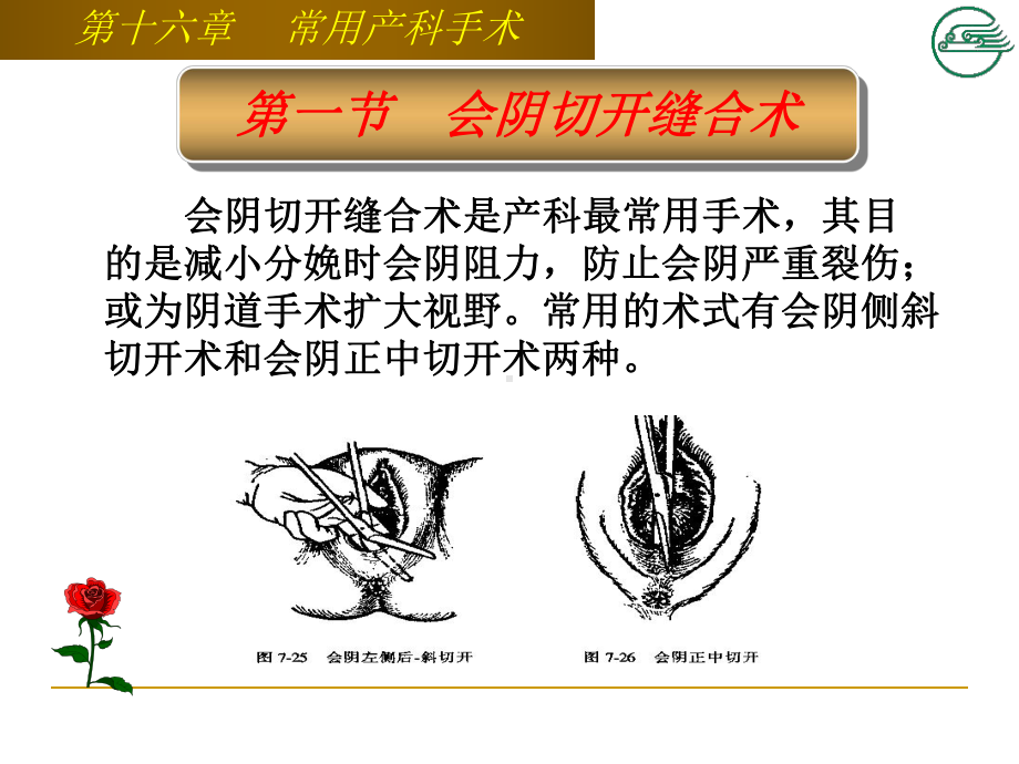 第十六章-产科常用手术-ppt课件共54页.ppt_第3页