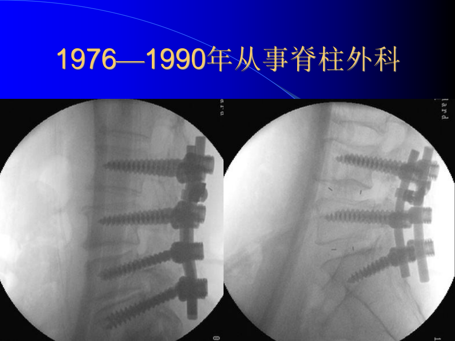 从开放手术到BEIS技术学习历程课件.ppt_第2页