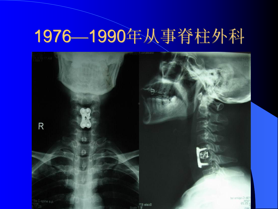 从开放手术到BEIS技术学习历程课件.ppt_第3页