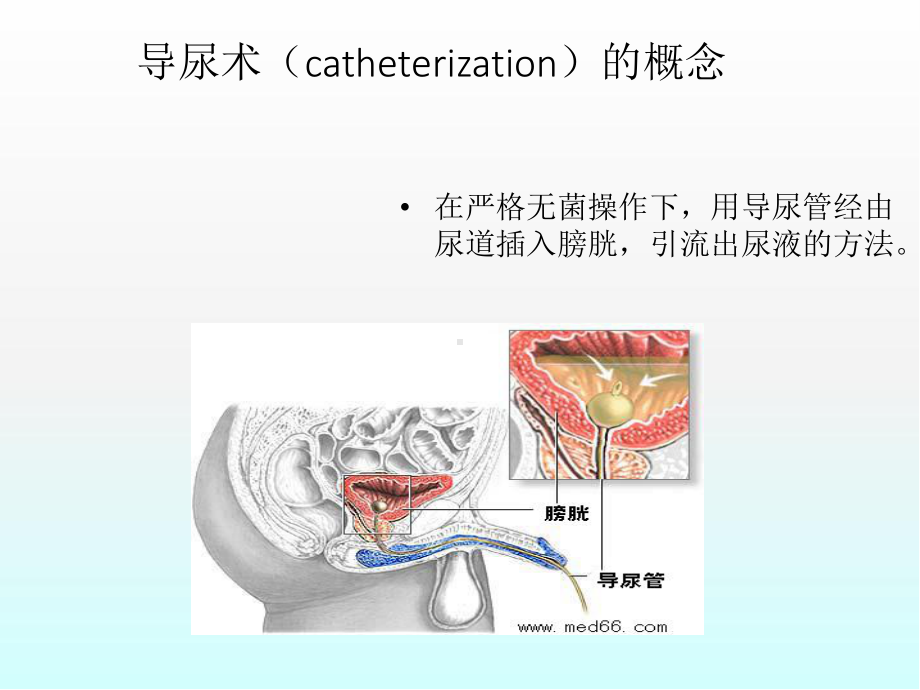 男性导尿常见问题防范及处理医学PPT课件.ppt_第3页