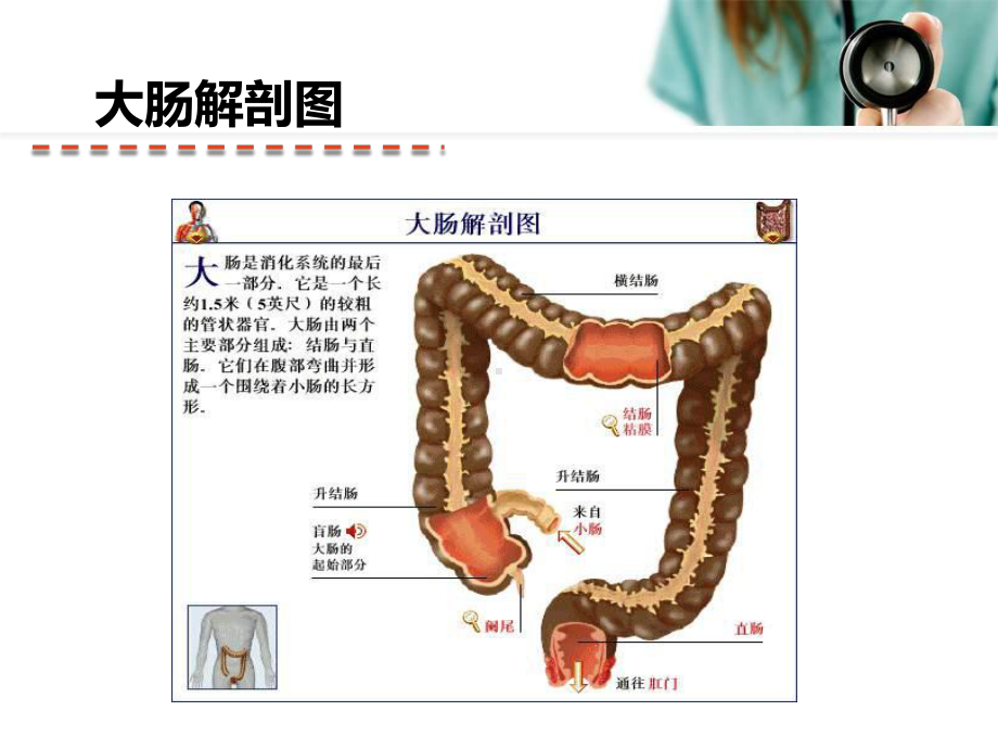 直肠癌根治术术后护理PPT医学课件.ppt_第3页