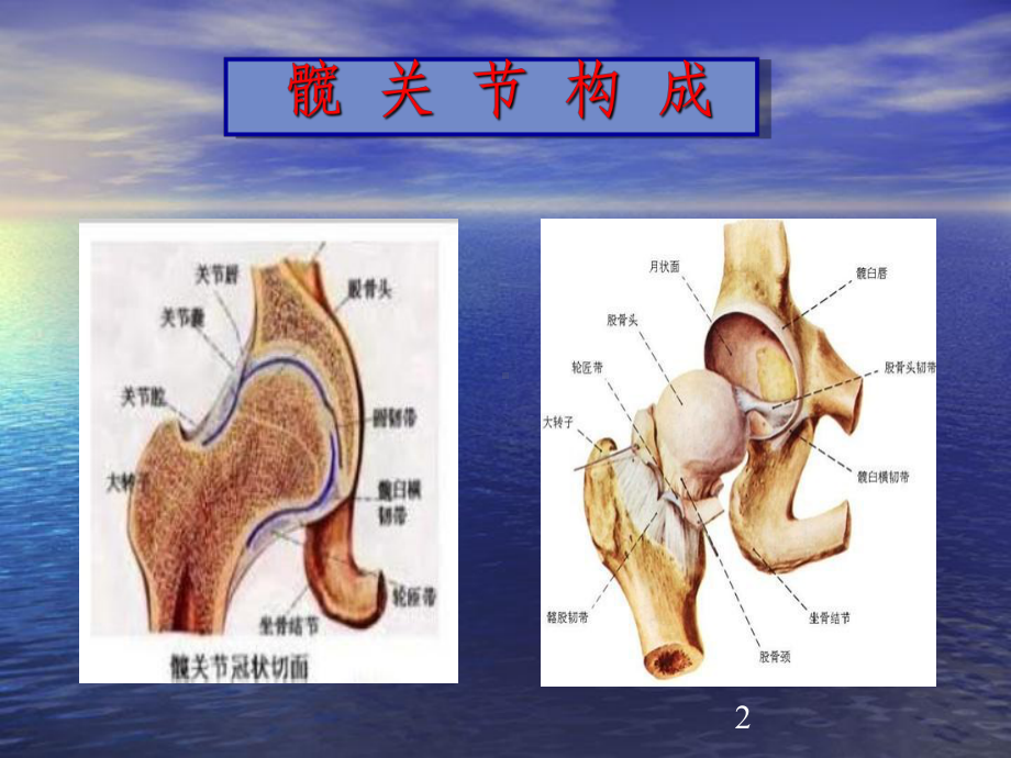 股骨颈骨折空心钉内固定选择课件.ppt_第2页