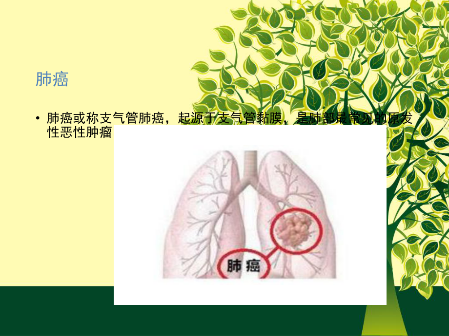 肺癌的发病机理课件.ppt_第2页