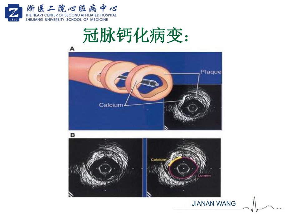 成都心血管会议交流课件.ppt_第2页