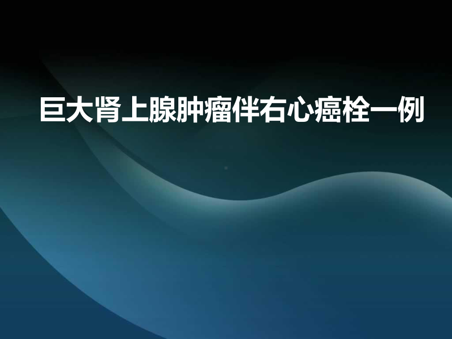 巨大肾上腺肿瘤伴右心癌栓一例课件.ppt_第1页