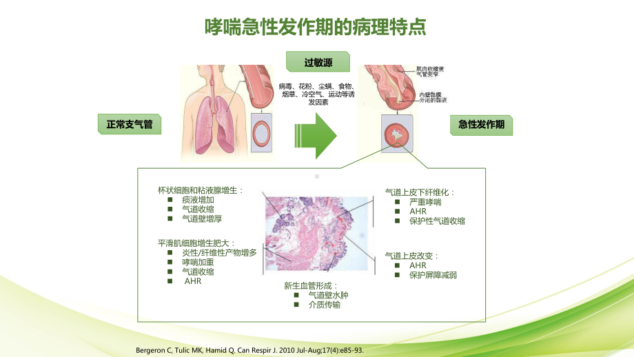 从急性期到维持期-儿童哮喘全程管理课件.pptx_第3页