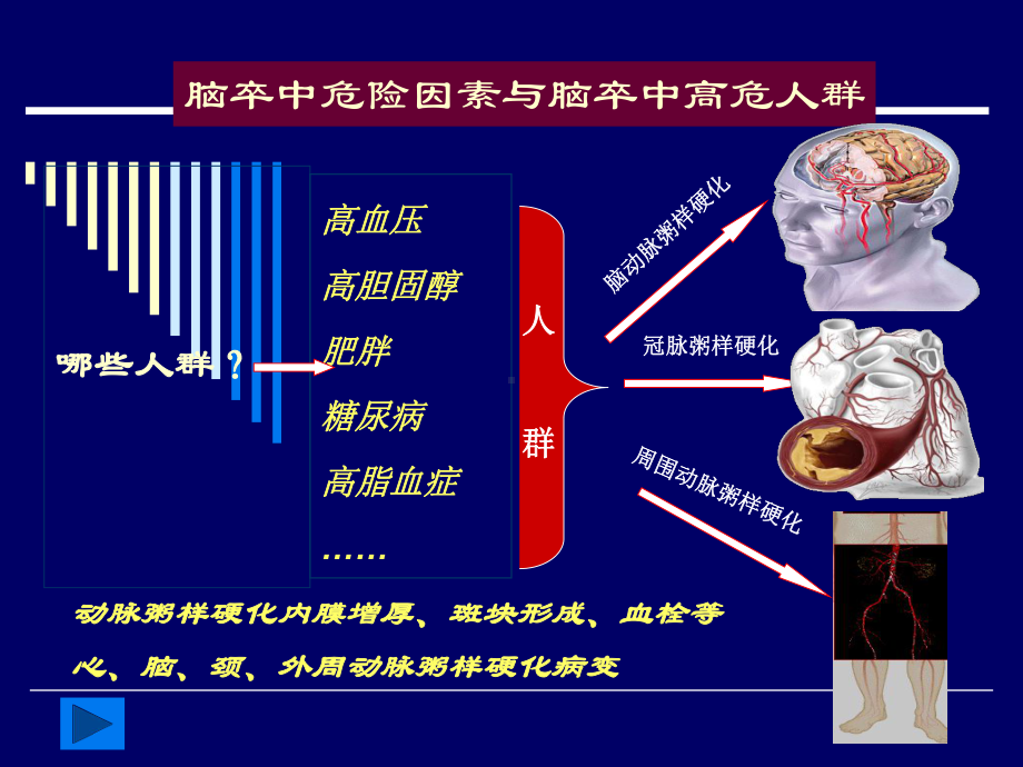 脑卒中讲义筛查血管超声检查课件.ppt_第3页