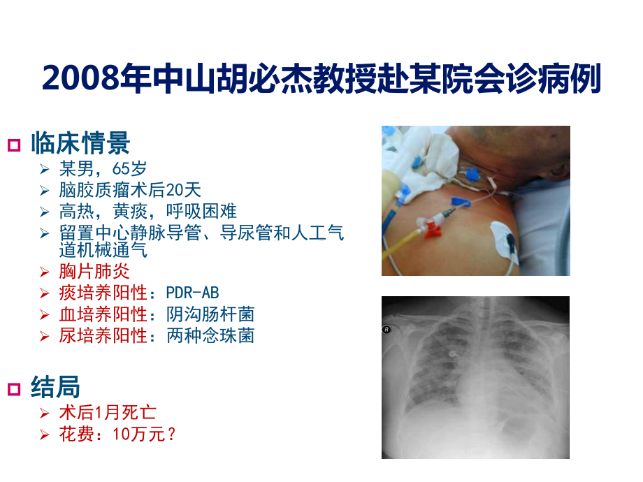 呼吸机相关性肺炎VAP的防控课件.pptx_第2页