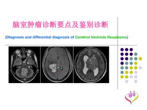 脑室肿瘤诊断要点及鉴别诊断课件.ppt