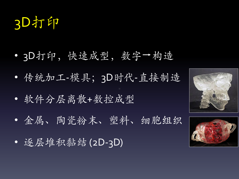 3D打印在骨盆肿瘤治疗中的应用课件.ppt_第2页