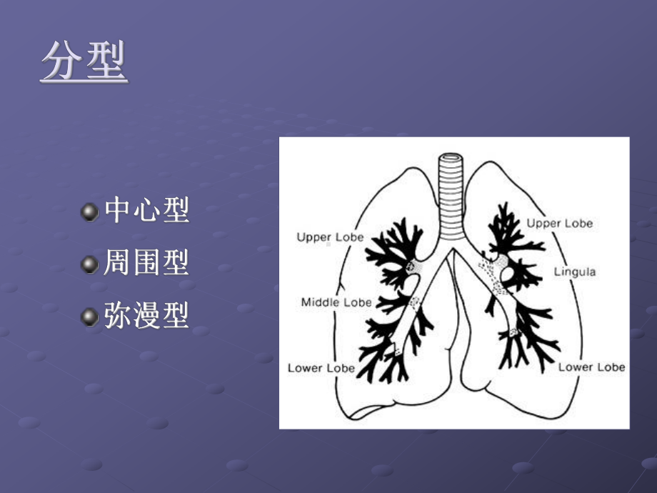 肺癌影像诊断讲课医学PPT课件.ppt_第2页