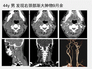 CBT-影像学诊断课件.ppt