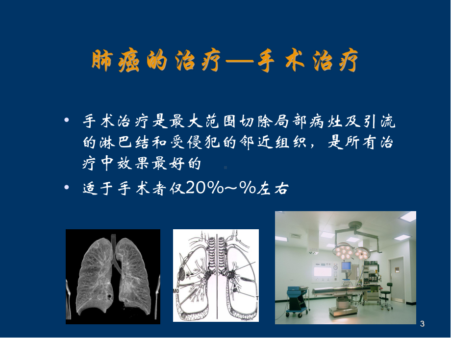 肺癌患者手术后康复指导幻灯片课件.ppt_第3页