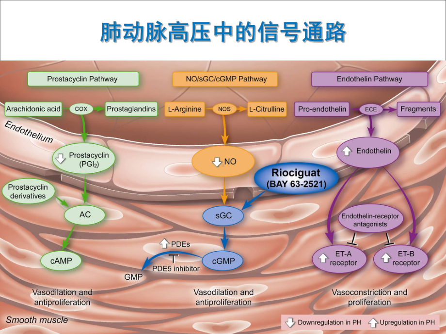 可溶性鸟苷酸环化酶激动剂在PAH与CTEPH中的治疗研究进展课件.ppt_第2页