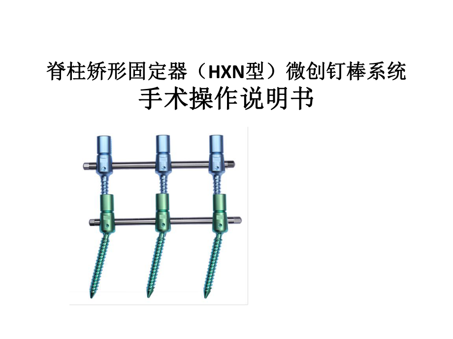 微创HXN椎弓根钉系统简单介绍与案例课件.pptx_第1页