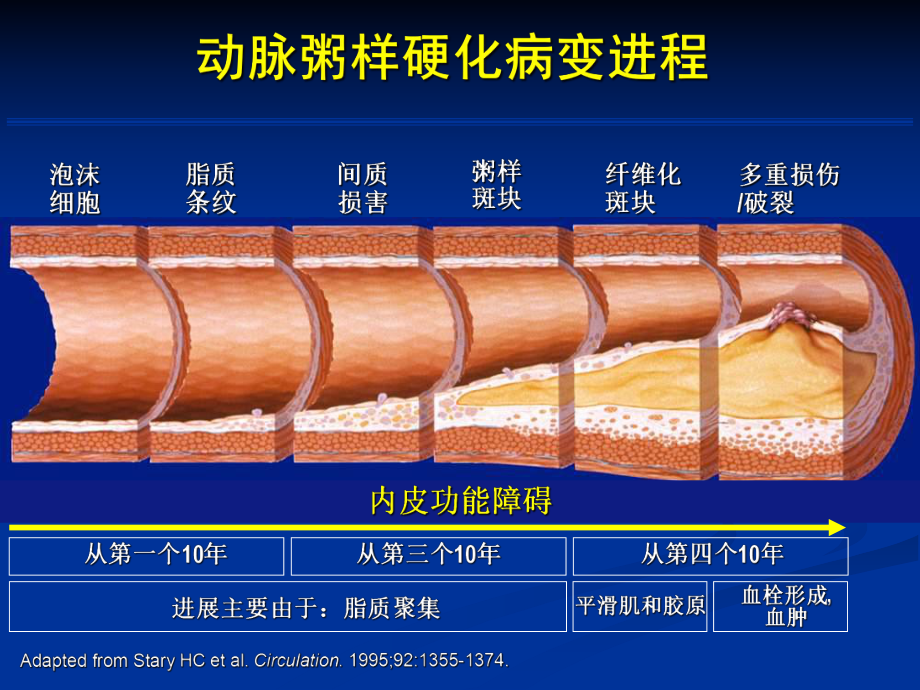 急性冠脉综合征伴课件.ppt_第2页