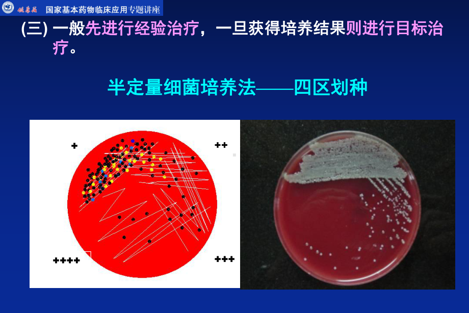 抗生素临床合理应用(杭州培训课件.ppt_第3页