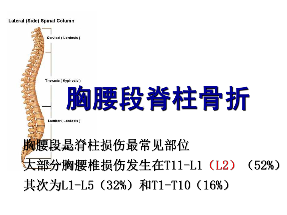 胸腰段脊柱骨折内固定范围的选择课件.ppt_第2页