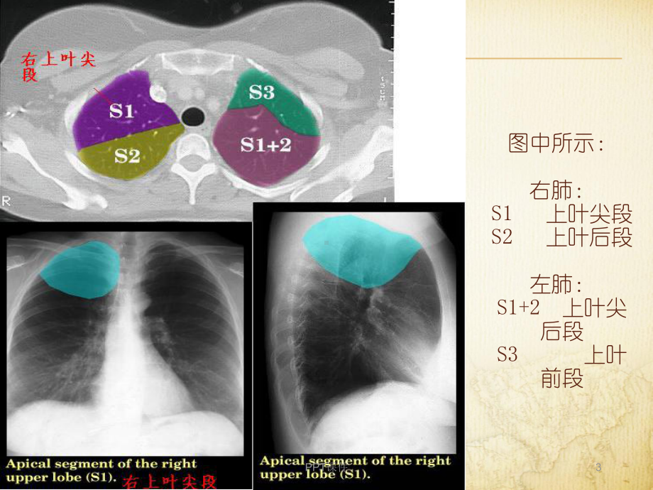 肺段CT解剖图及定位口诀-ppt课件.ppt_第3页