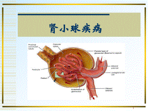 肾小球疾病PPT医学课件.ppt