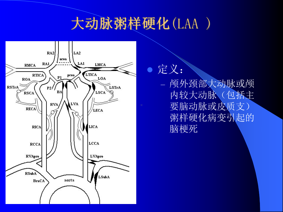 从缺血性卒中发病原因和机制分析抗栓药物的选择课件.ppt_第3页