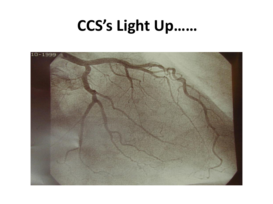 CCS冠状动脉造影注射器课件.ppt_第3页