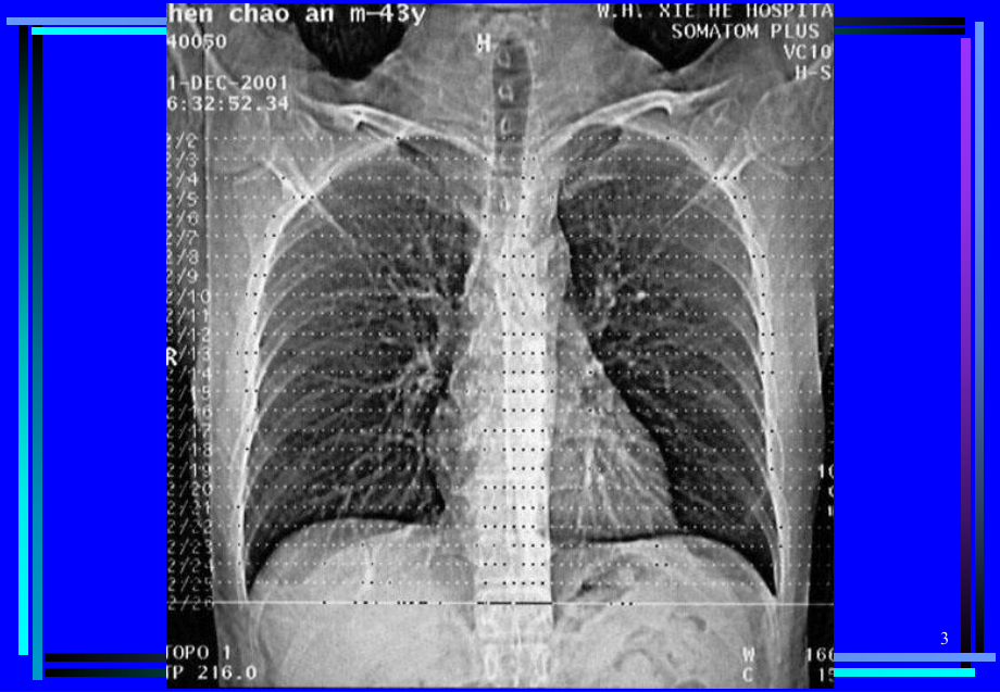 胸部CT诊断(大量实例CT片)医学PPT课件.ppt_第3页