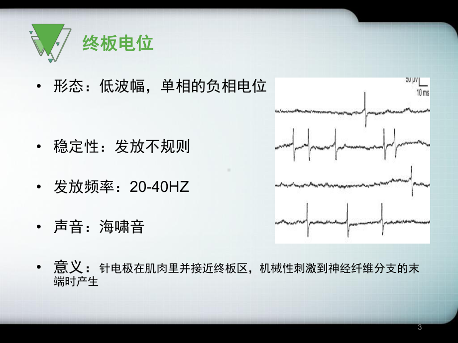 肌电图基础知识之电位分析医学PPT课件.ppt_第3页