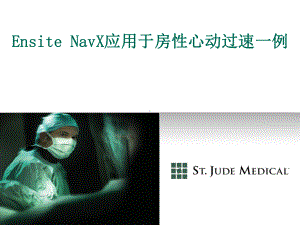 Ensite-NavX应用于房性心动过速一例课件.pptx