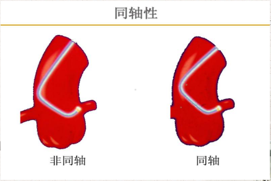 冠脉介入培训讲课导引导管和导引导丝的选择及操作上课件.pptx_第3页