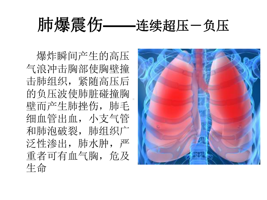 肺爆震伤-PPT课件.ppt_第3页