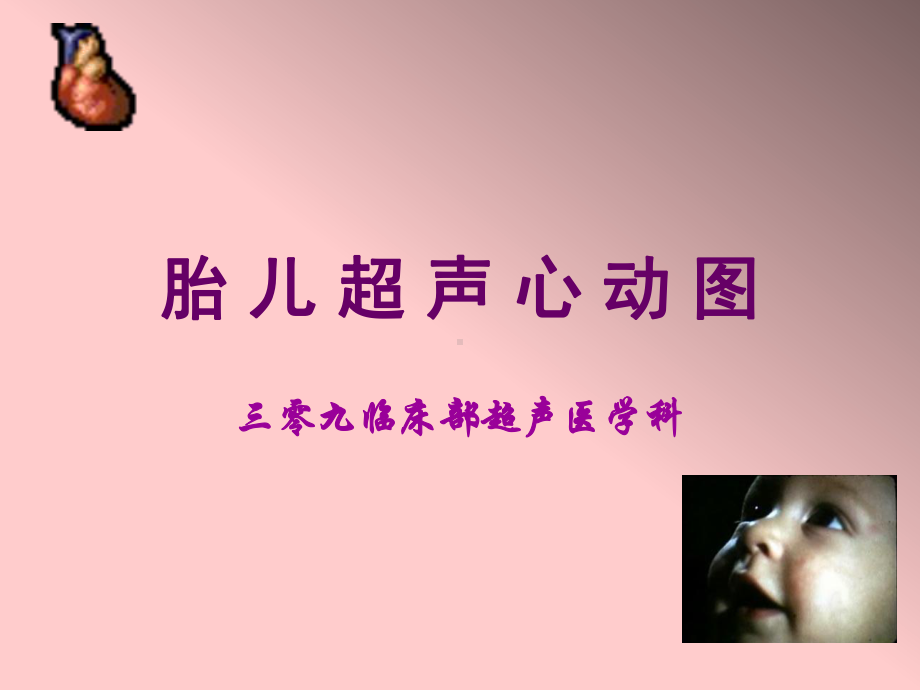 胎儿超声心动图.ppt-PPT课件.ppt_第1页