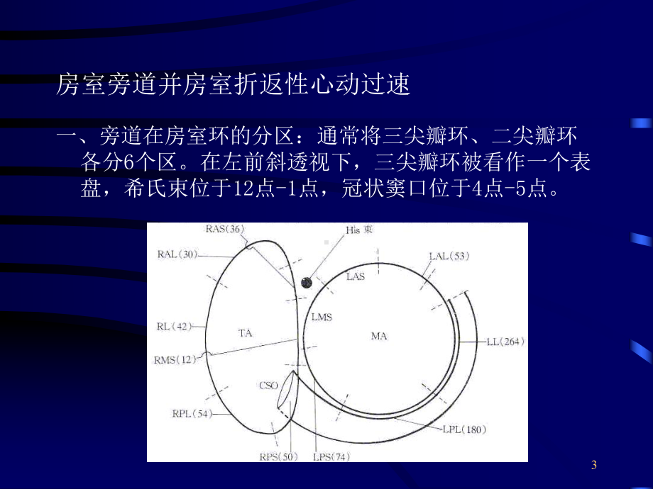 室上性心动过速的射频消融课件.ppt_第3页