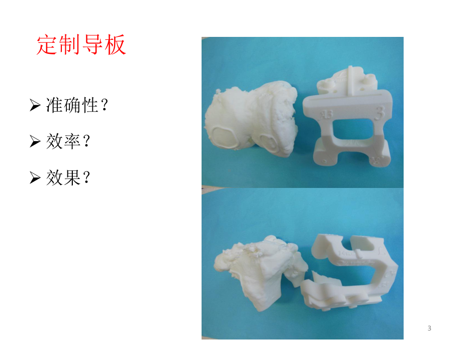 3D打印在TKA中的应用课件.pptx_第3页