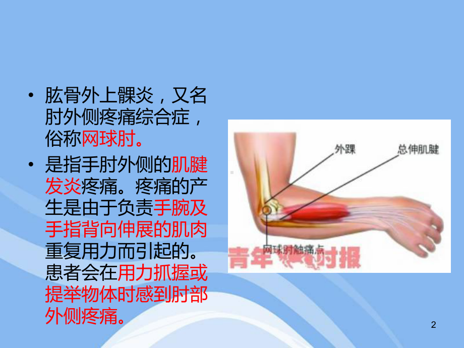 肱骨外上髁炎PPT医学课件.ppt_第2页