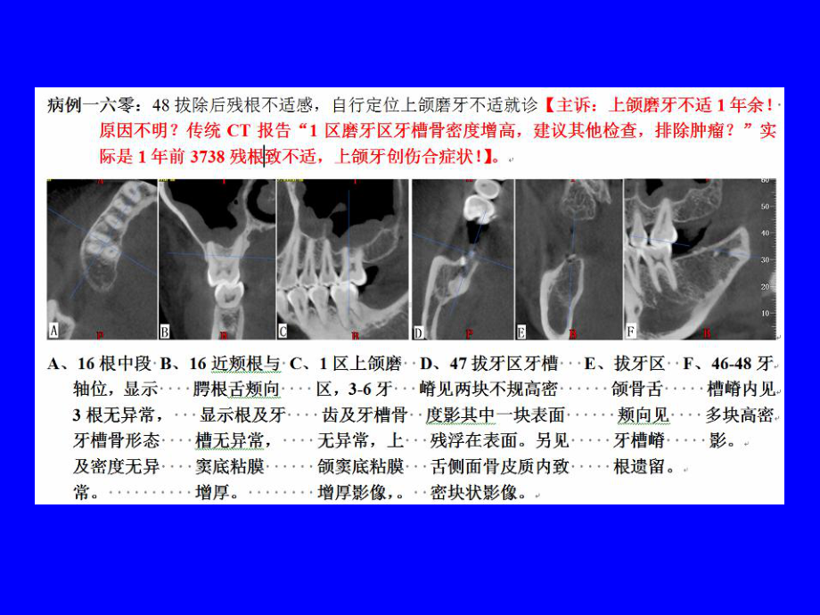 CBCT寻找无自主定位不适感原因课件.ppt_第2页