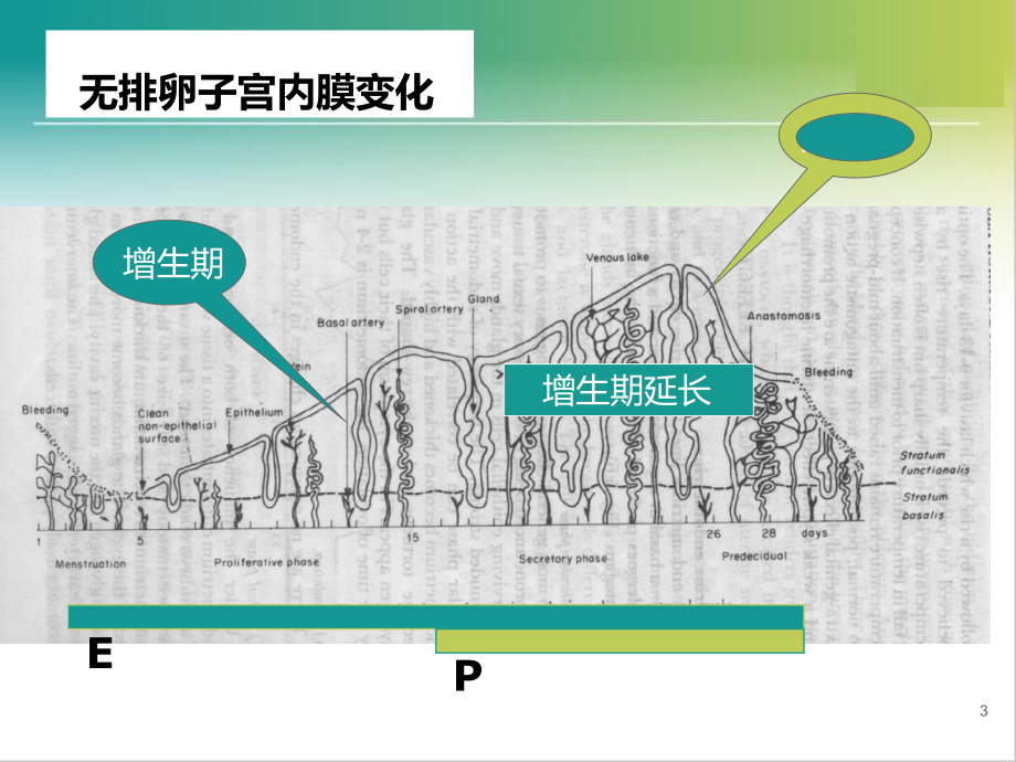 内膜增生指南解读课件.pptx_第3页