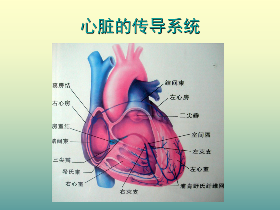 icu常见心律失常-ppt课件.ppt_第3页