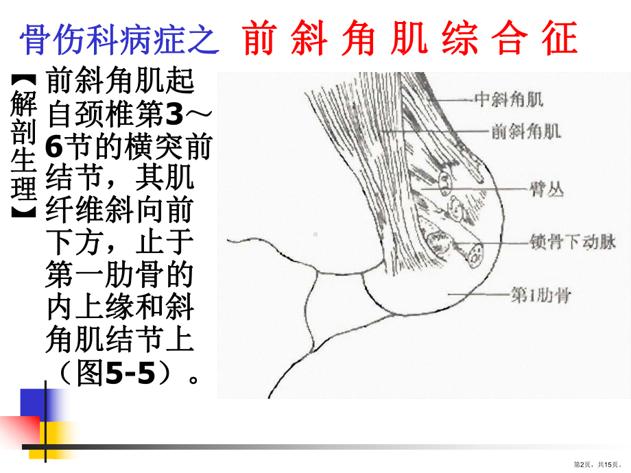 《前斜角肌综合征》PPT课件(PPT 15页).pptx_第2页