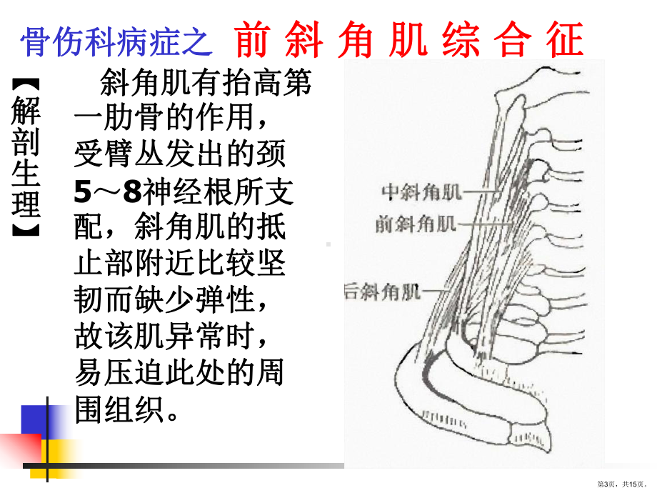 《前斜角肌综合征》PPT课件(PPT 15页).pptx_第3页