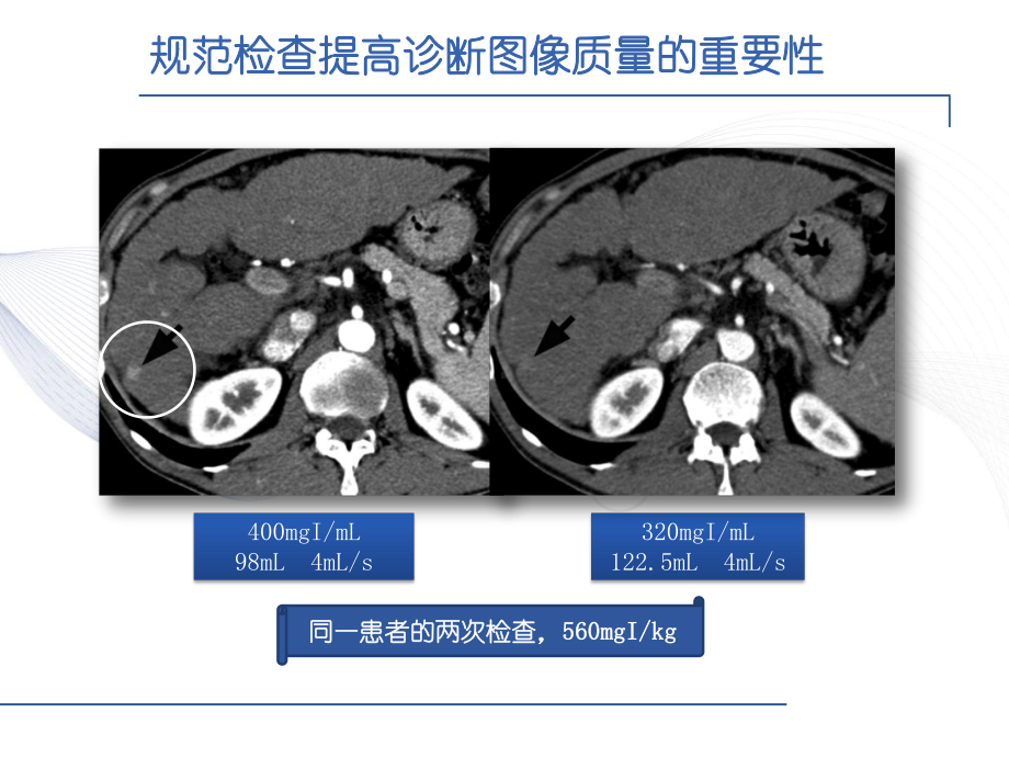 高浓度对比剂在实质脏器的应用优势课件.pptx_第3页