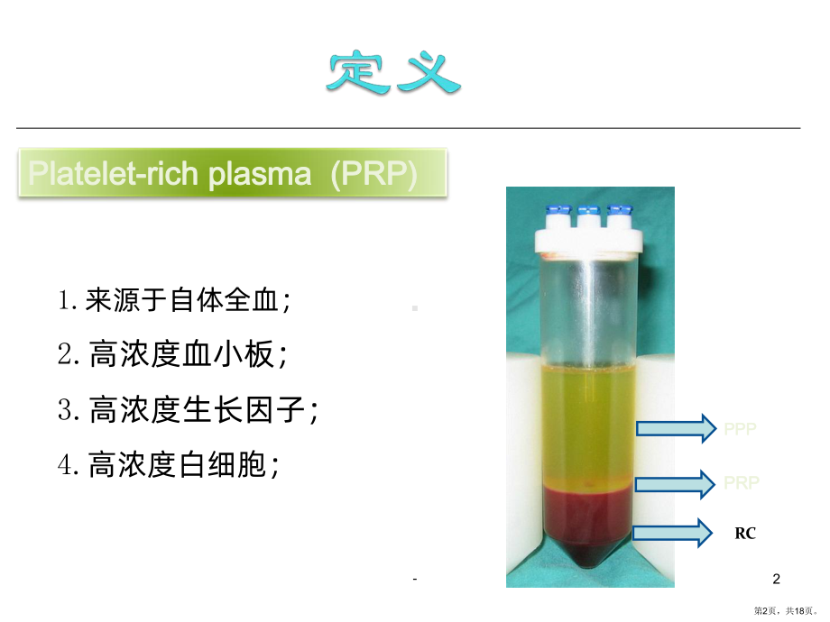 PRP复合自体骨治疗PPT课件(PPT 18页).pptx_第2页