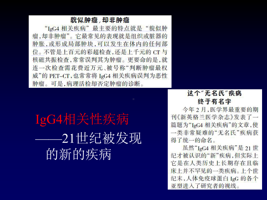 IgG4相关性疾病的诊治ppt课件.ppt_第2页