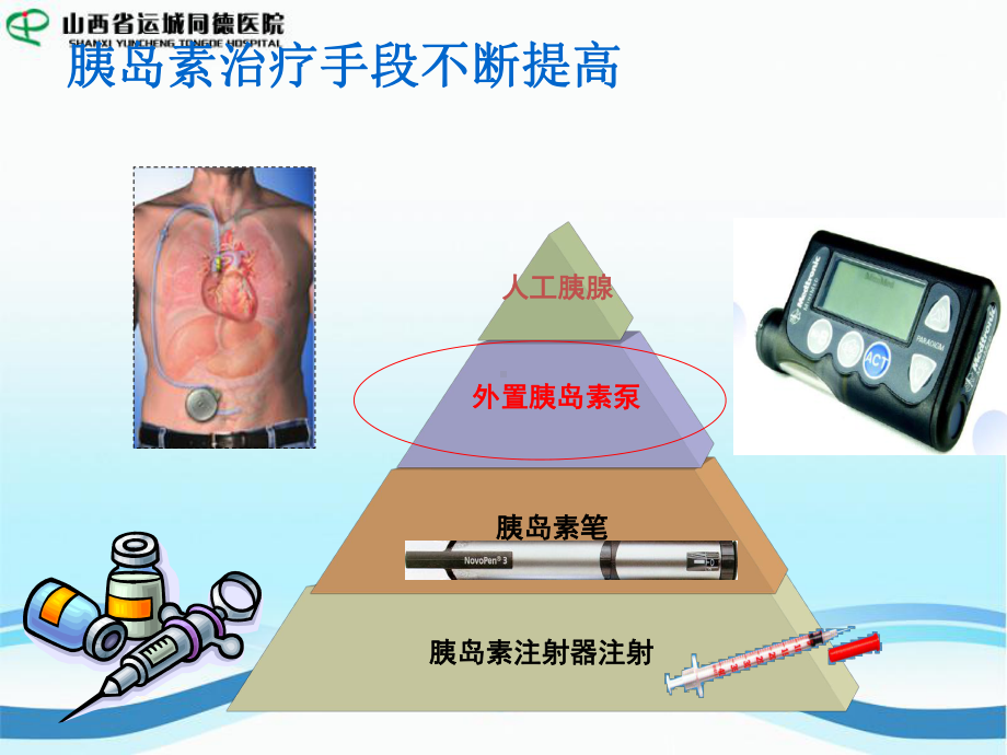 胰岛素泵的个体化血糖控制目标课件.ppt_第1页