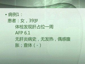 脑室肿瘤诊断与鉴别课件.ppt