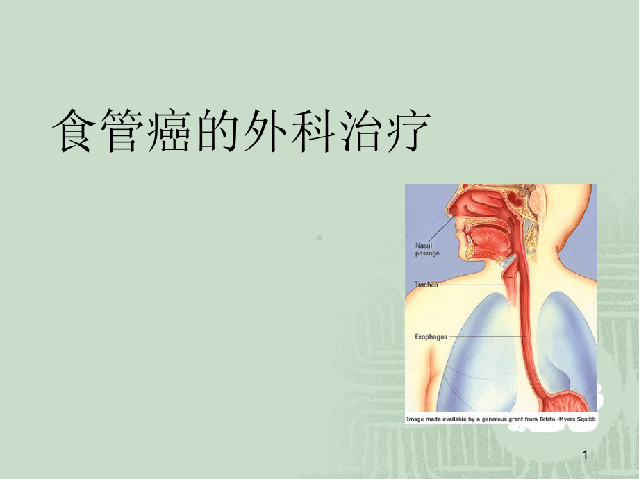 食管癌手术治疗医学PPT课件.ppt_第1页