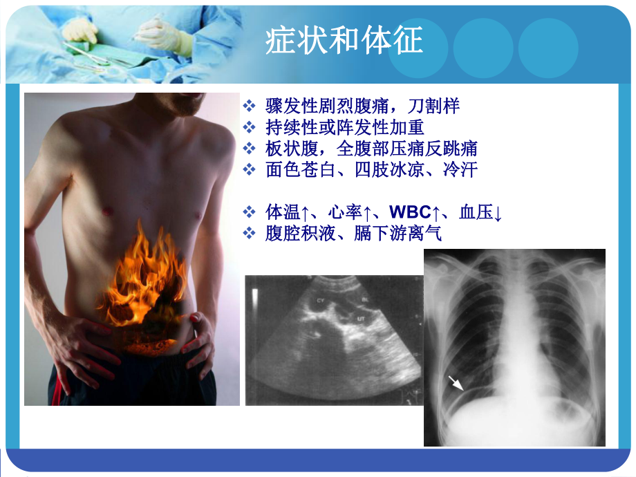 胃修补+静脉切开课件.ppt_第2页