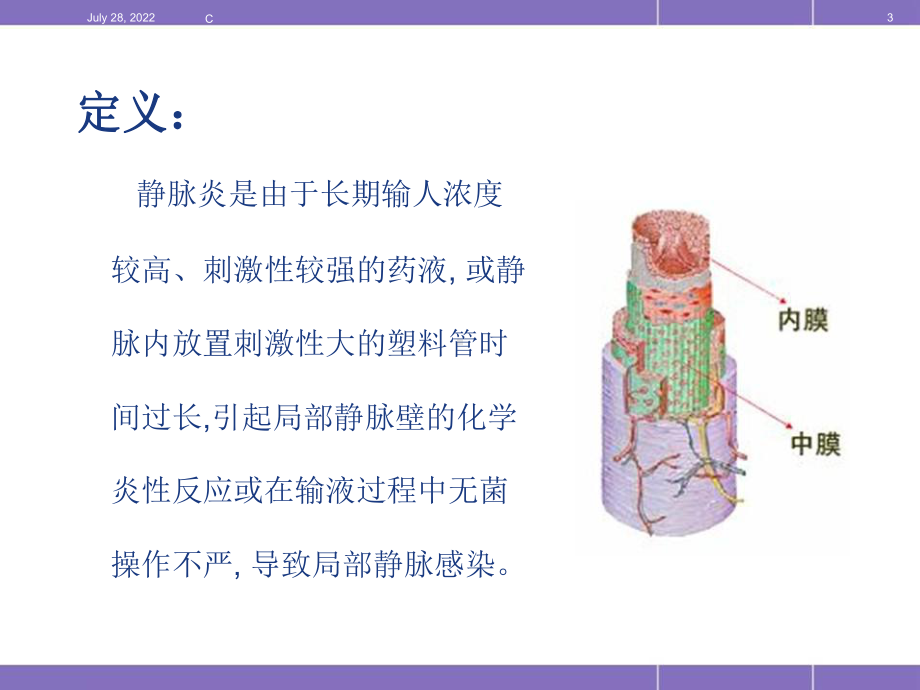 静脉炎的预防和处理PPT医学课件.ppt_第3页